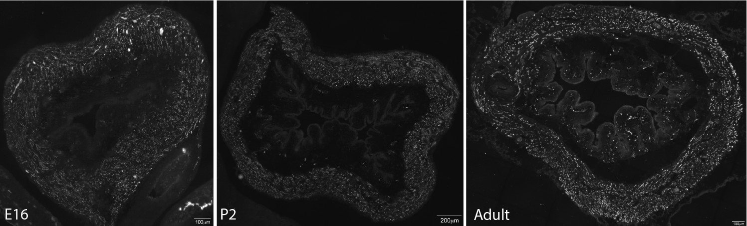 Figure 2A: Structure of cholinergic motor axons in the bladder adult mouse . Examples of cholinergic axons immunolabelled for vesicular acetylcholine transporter VAChT; Slc18a3 in cryosections of mouse bladder at E16 See GUDMAP RID N-FKKE , P2 See GUDMAP RID N-FN0P and adult See GUDMAP RID N-FNFP .