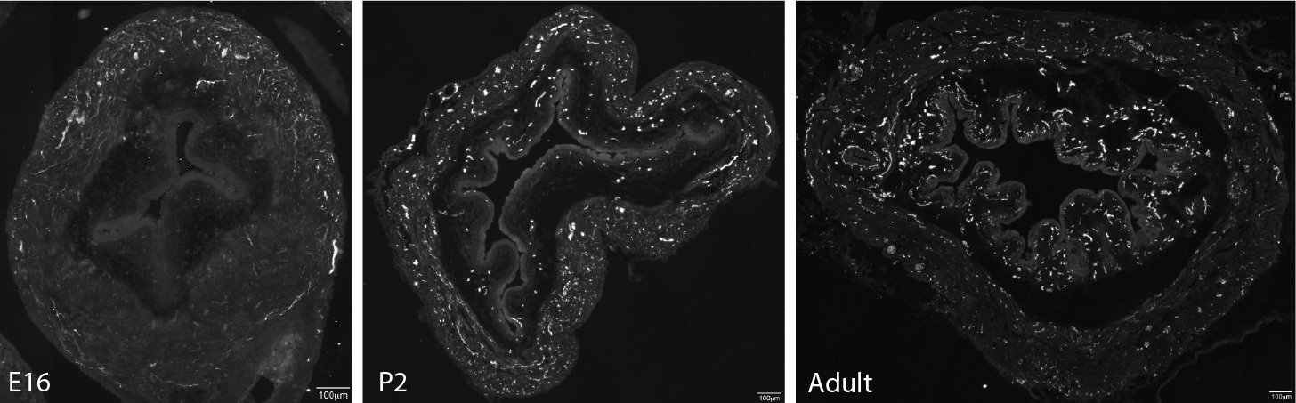 Figure 3A: Structure of peptidergic sensory axons in the bladder adult mouse . Examples of sensory axons immunolabelled for calcitonin gene-related peptide CGRP; Calca in cryosections of mouse bladder at E16 See GUDMAP RID N-FM22 , P2 See GUDMAP RID N-FN1T and adult See GUDMAP RID N-FNF2 .