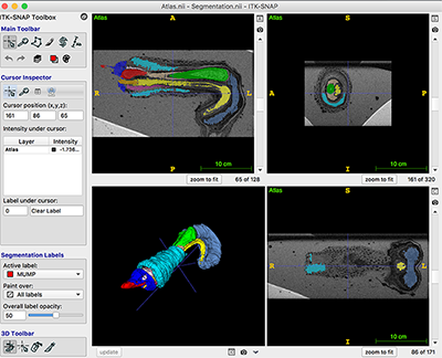 3D image of adult mouse genitourinary organ