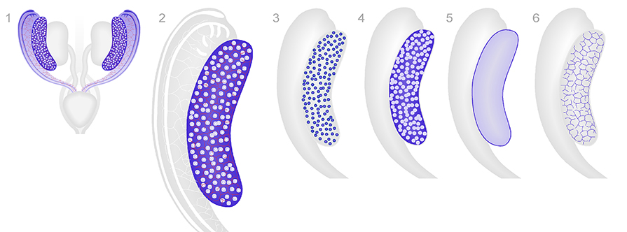 Major anatomical structures of the ovary. Schematic diagrams show 3-dimensional views of the female reproductive system. The images are ventral views at approximately TS21 13 dpc . Diagram of the urogenital system of female shows the kidneys, ureters and bladder in grey, and the ovary and mesonephroi in blue 1 . The upper part of the female reproductive system includes the mesonephros of female and ovary 2 . Diagrams 3 to 6, highlight different components of the ovary, including; germ cells 3 , mesenchymal stroma 4 , surface epithelium 5 and developing vasculature 6 of ovary.