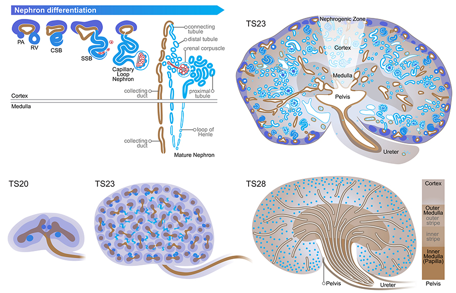 Nephrogenesis and nephron differentiation. Top row: Nephrogenesis is the process whereby cells of the cap mesenchyme dark blue undergo a mesenchymal to epithelial transition to form a nephron. Left: Nephron differentiation is illustrated in this schematic diagram and proceeds from early nephron dark purple to mature nephron light blue . Pretubular aggregates PA form from cap mesenchyme cells dark blue , in a specific location underneath the ureteric tips, in response to signals from the ureteric tree. Renal vesicles RV , Stage I nephrons, are immature epithelial vesicles. Comma-shaped bodies CSB have developed a cleft and are connected to the tips. S-shaped bodies SSB, Stage II nephrons have developed visceral and parietal epithelial layers in their proximal end and endothelial cells begin migrating into the cleft. Capillary loop stage nephrons Stage III have an immature capillary network and their tubules are located within the cortex, close to the periphery of the kidney. Maturing and mature nephrons Stage IV have developed a vascularised renal corpuscle and their tubules have differentiated into distinct tubular segments. The loops of Henle have descended into the medulla by TS23 15 dpc . Right: Diagrammatic sagittal section of a TS23 15 dpc kidney showing the metanephros layers; nephrogenic zone, cortex, medulla and pelvis. Bottom row: Left: Schematic diagrams show 3-dimensional views of the kidney and ureter at TS20 12 dpc and TS23 15 dpc . At TS20, the kidneys are comprised of a renal capsule, cap mesenchyme dark purple , nephrogenic interstitium light purple , the ureteric tree brown and developing nephrons including pretubular aggregates, renal vesicles and comma-shaped bodies. By TS23 15 dpc , all nephron stages are seen in the kidney and the most mature nephrons present are referred to as maturing nephrons Stage IV . Nephron structures in the periphery of the kidney dark blue include; PA, RV, CSB, S-shaped bodies, capillary loop stage nephrons and the renal corpuscles and cortical tubules of maturing nephrons. Loops of Henle of maturing nephrons are located in the centre of the kidney light blue . Ureteric tips brown are also located on the surface of the kidney. Right: By TS28 adult , nephrogenesis has ceased, there is no nephrogenic zone and all nephrons have matured, having developed distinct tubular segments. The kidney is subdivided into cortex, outer medulla inner and outer stripes , inner medulla often called papilla and pelvis. Renal corpuscles blue circles are only present in the cortex, however, different tubular nephron segments are located in different regions of the kidney. During postnatal development, the inner medulla extends into the proximal ureter. Collecting ducts brown form the drainage system of the kidney which opens into the ureter. For a complete list of the structures present in each region of the kidney refer to the ontology pages.
